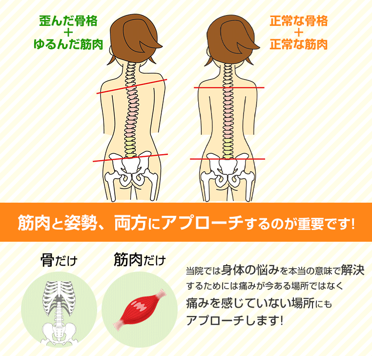 アプローチします